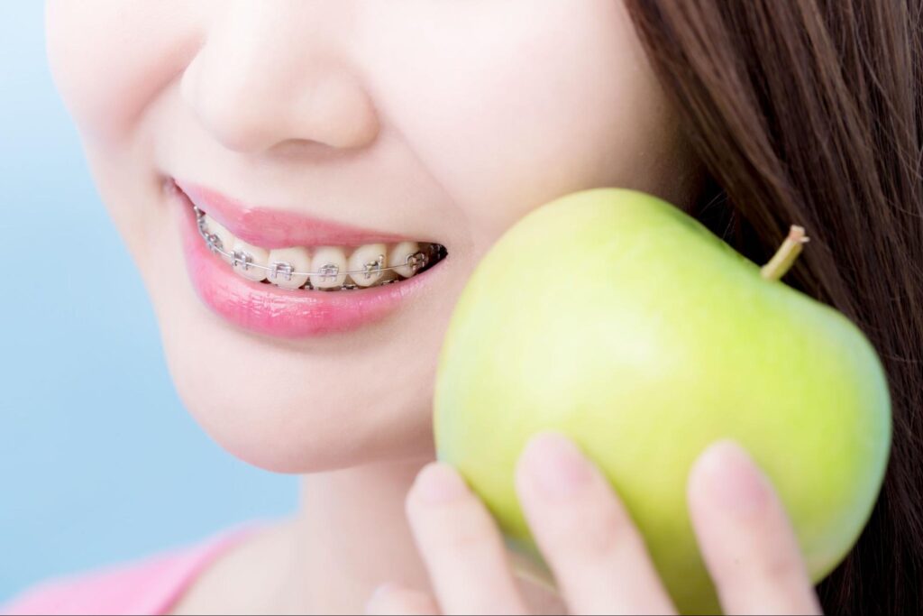 5 Delicious Recipes for Braces-Safe Snacks