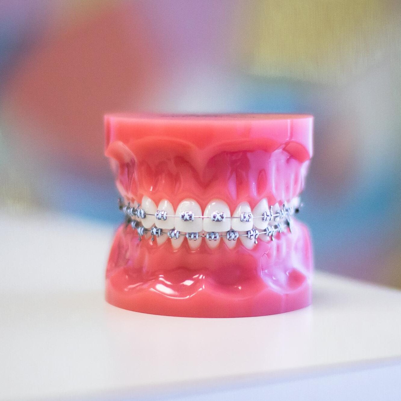 IMG_5734 Metal Braces